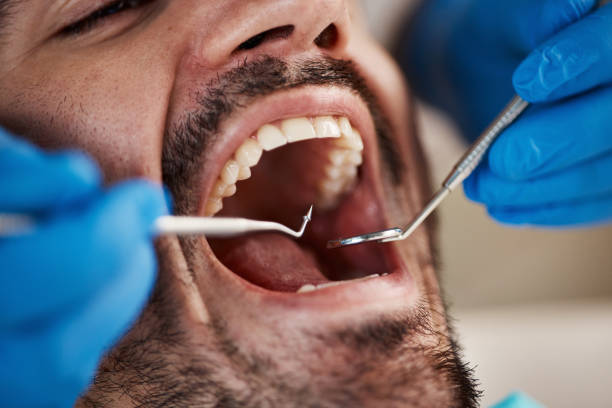 Dental Bonding in Winters, TX